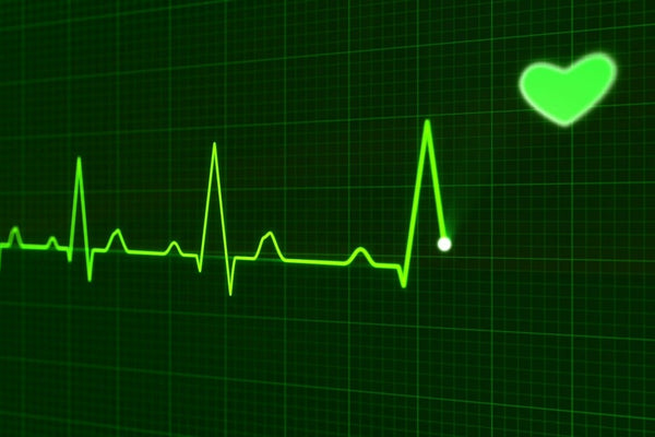 See your EKG
